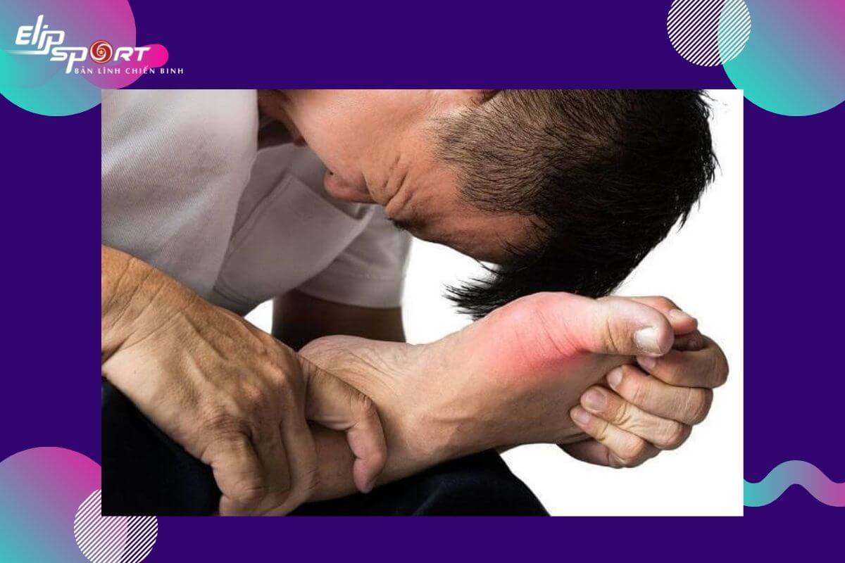 bị Gout nên làm gì