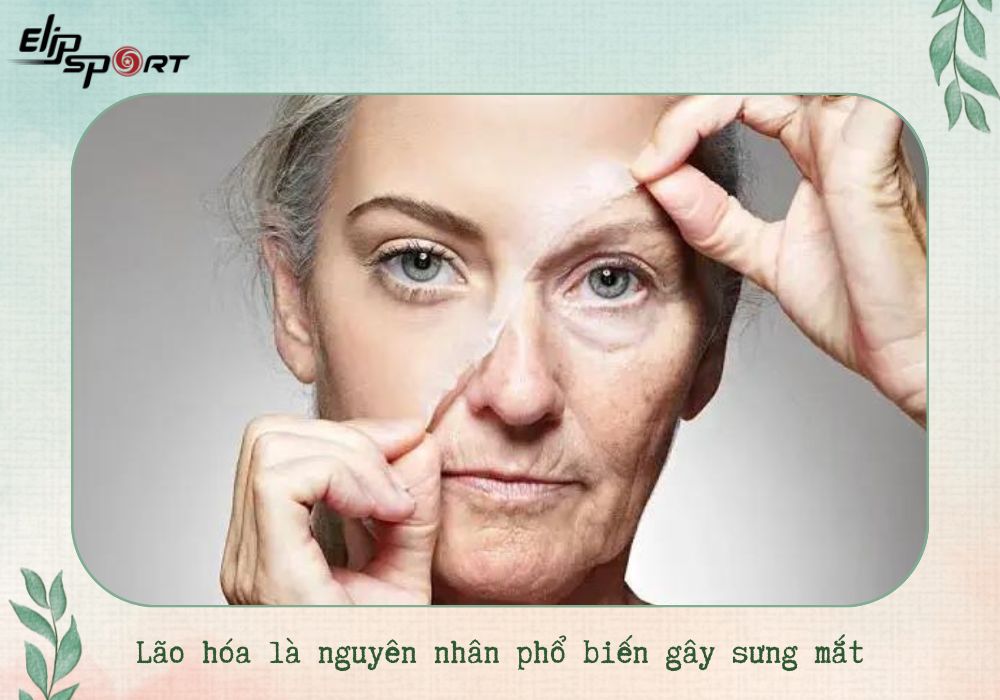 L&atilde;o h&oacute;a l&agrave; nguy&ecirc;n nh&acirc;n phổ biến g&acirc;y sưng mắt