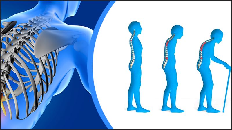 Cung cấp kho&aacute;ng chất cho người bị lo&atilde;ng xương