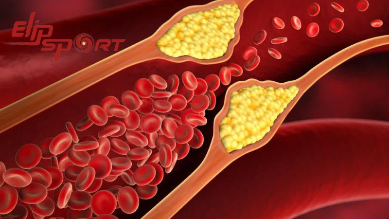 Giảm nồng độ cholesterol