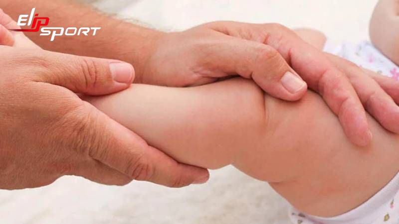 b&eacute; bị ch&acirc;n v&ograve;ng kiềng