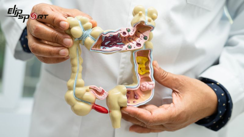 C&aacute;c chất trong nếp cẩm gi&uacute;p cải thiện hệ ti&ecirc;u h&oacute;a