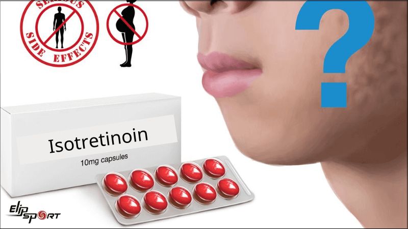 Isotretinoin l&agrave; một loại thuốc mạnh m&agrave; c&aacute;c mẹ bầu n&ecirc;n tr&aacute;nh
