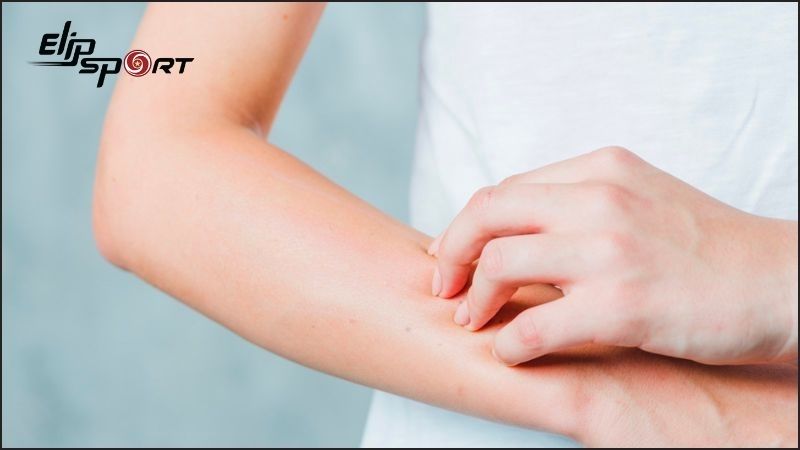 Người bị dị ứng kh&ocirc;ng n&ecirc;n uống