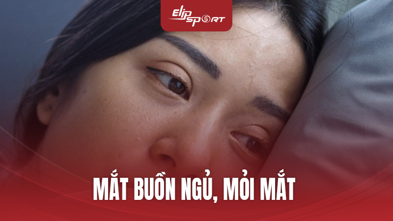Mắt Buồn Ngủ, Mỏi Mắt: Nguyên Nhân Và Cách Khắc Phục Hiệu Quả Từ Jun8892 Trang Chính Thức