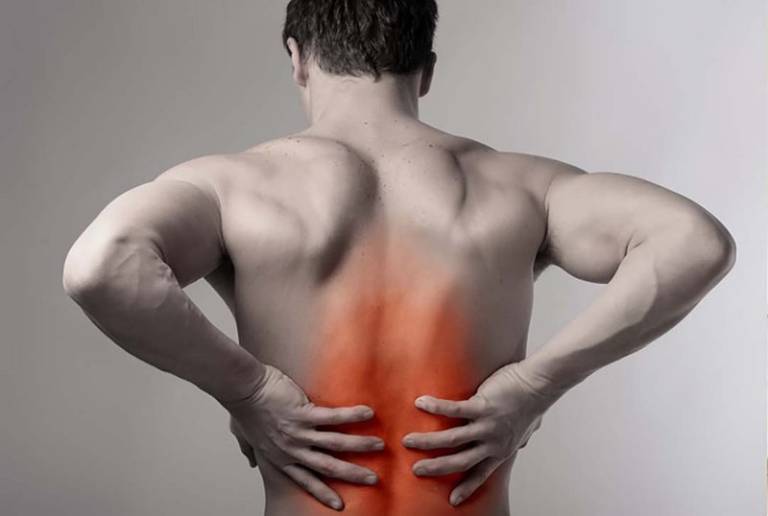 Căng cơ lưng là bệnh gì? Dấu hiệu nhận biết và cách khắc phục